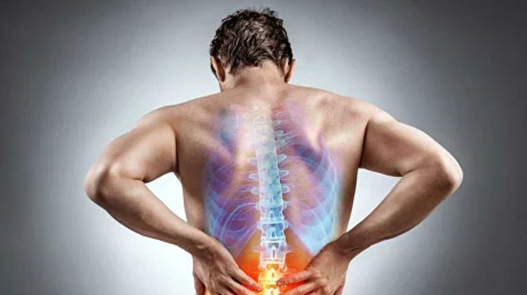 Боли в спине: классификация, причины и факторы риска, обследование и лечение пациентов с болью в позвоночнике